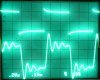 10KHz + 1uF.JPG 10KHz + 1uF.JPG